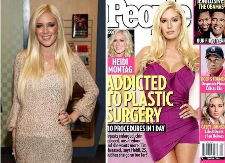 Heidi Montag Before and After Picture